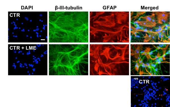 Cell imaging analysis; immunofluorescence staining showing β-III-tubulin and GFAP in neural cells.