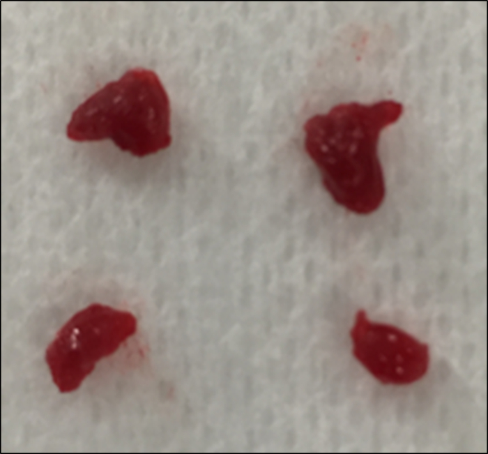 figure-results-4 Fresh tissue sample on absorbent pad; biological specimen for microscopic analysis.