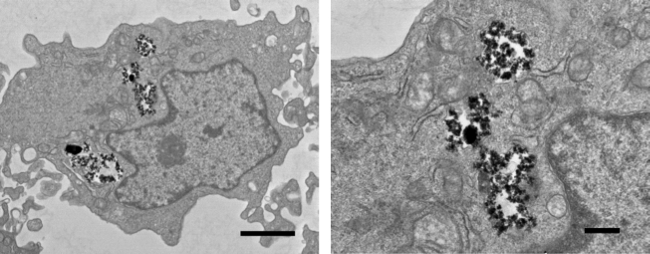 Cellular structures in electron microscope images, highlighting subcellular components for analysis.