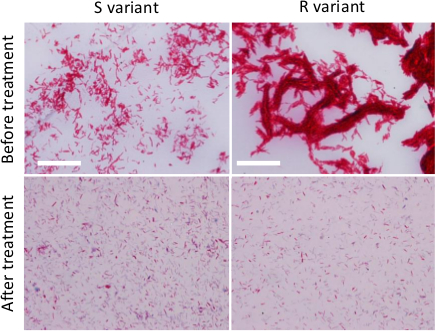 Bacterial response to treatment, microscope image; S and R variants before and after antibiotic application.