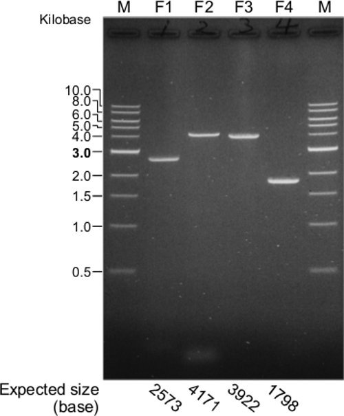Resultados de electroforesis de ADN; gel que muestra la separación de fragmentos de ADN por tamaño en kilobases; marcadores moleculares.