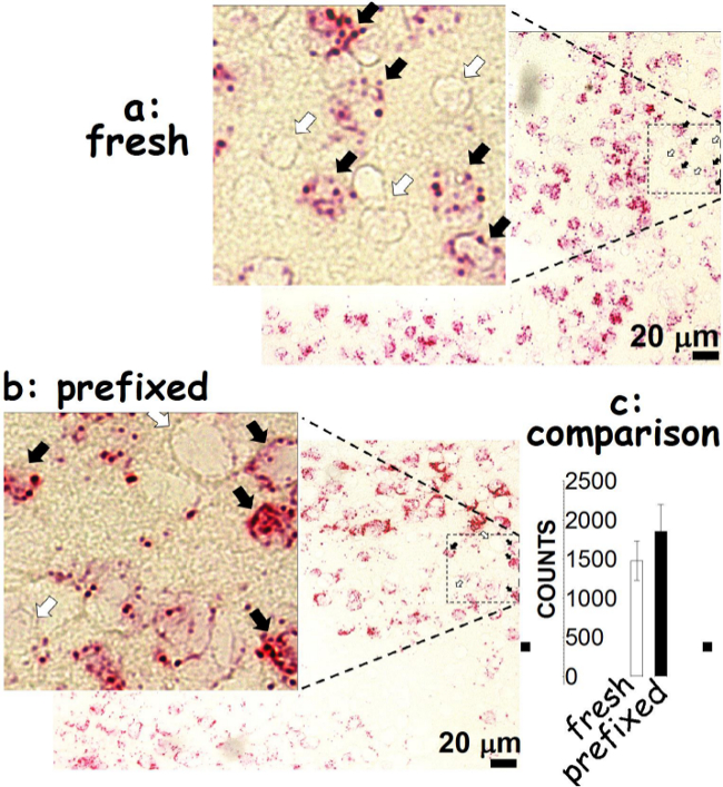 Cell staining comparison: fresh vs prefixed, microscopic image with quantitative bar chart results.