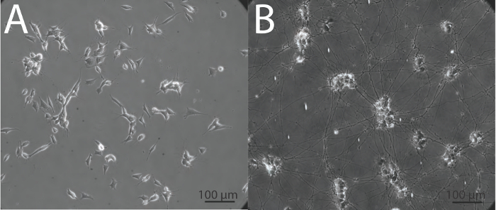 figure-results-2 Cell morphology comparison; A: fibroblast-like, B: neural network, microscope image.