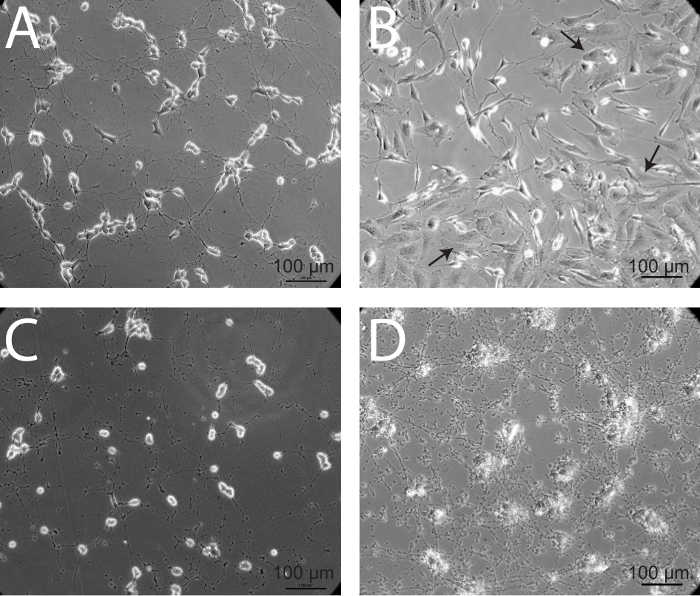 figure-results-5 Cell differentiation microscope images; stages A-D at 100µm scale, arrow indicates cell changes.