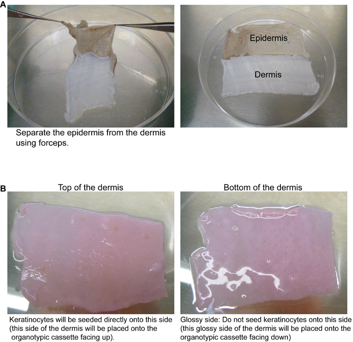 Epidermis-dermis separation using forceps; skin tissue preparation for organotypic culture analysis.