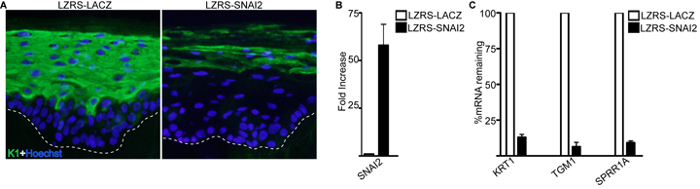 Immunofluorescence and qPCR results showing SNAI2's effects on mRNA, with epithelial markers.