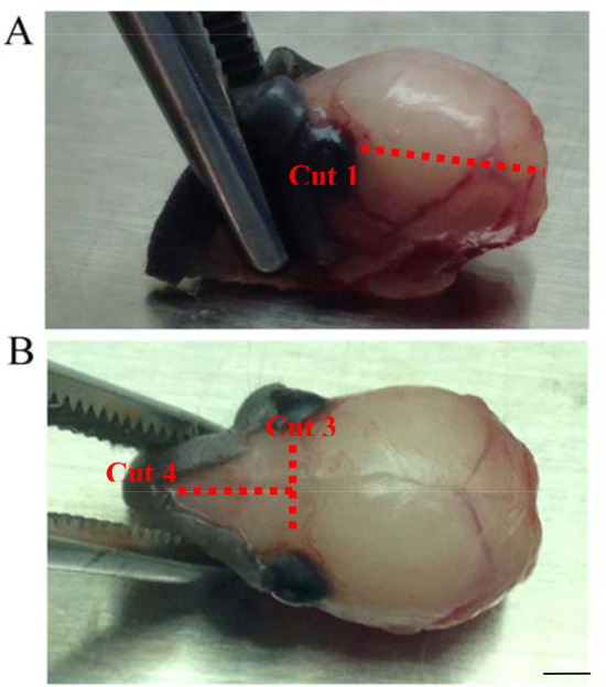 figure-protocol-2 Dissection process diagram; brain isolation cuts shown on specimen for anatomical study.