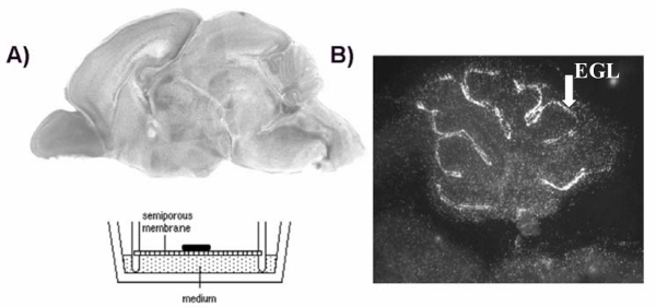 Brain section analysis, semiporous membrane setup; microscopy and histological study of cerebellum EGL.