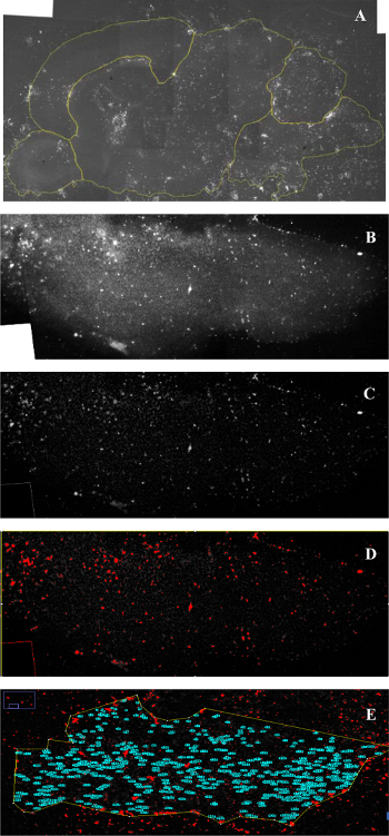 Microscope image series showing fluorescence in situ hybridization (FISH) for DNA analysis.