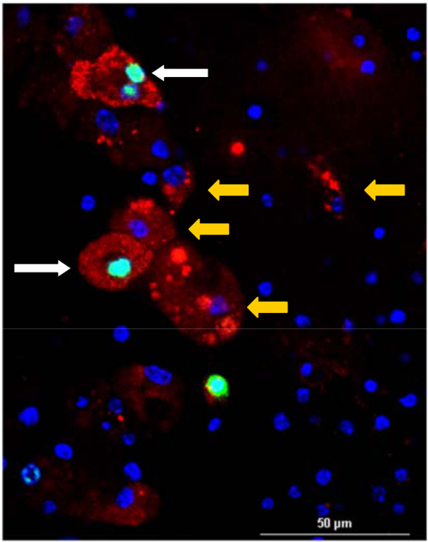 Fluorescence microscopy image highlighting cell nuclei (blue) and protein localization (red, green).
