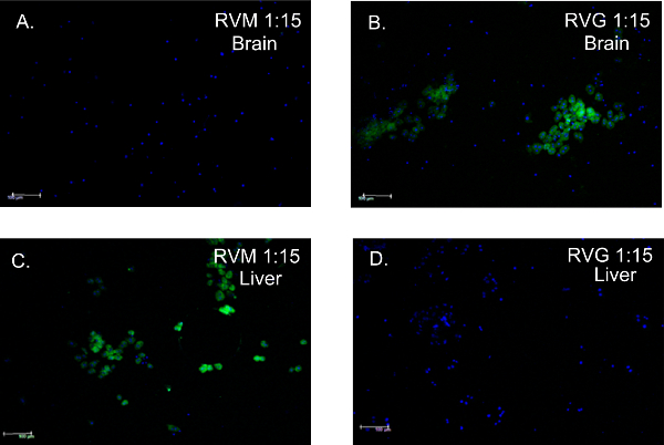 Fluorescence microscopy images of brain and liver cells; RVM/RVG 1:15 green labeling.