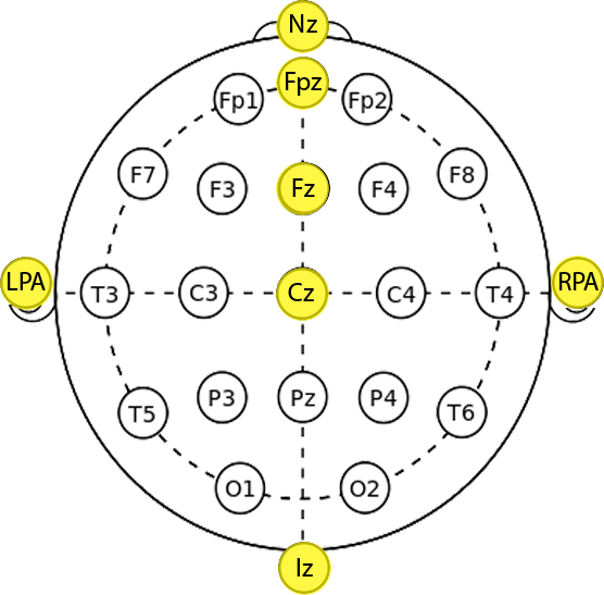 Electrode placement diagram in EEG system, highlighting positions such as Fpz, Cz, LPA, and RPA.