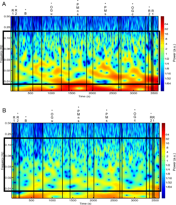 Wavelet power spectrum chart showing frequency vs. time; analysis of periodic signals in data.
