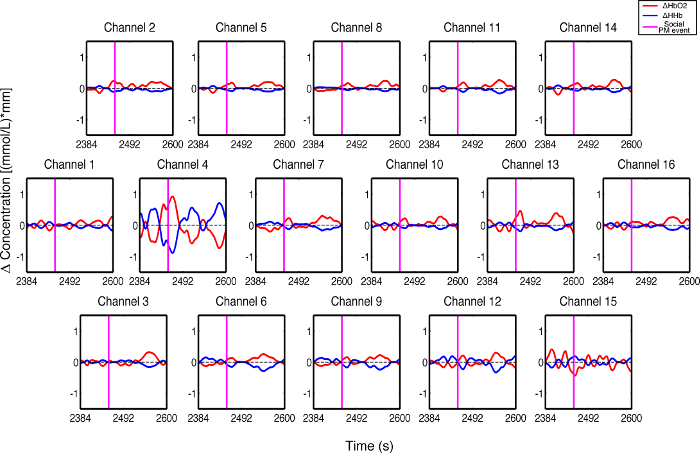 Multi-channel transient absorption spectra; concentration change over time; analysis in spectroscopy.