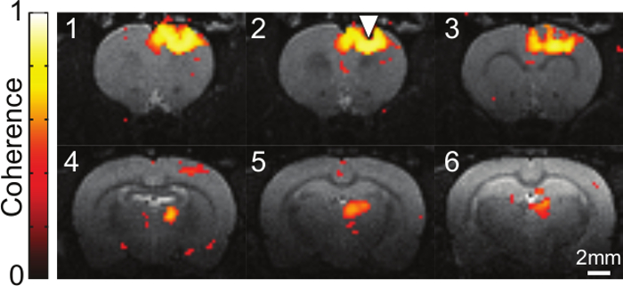 Functional MRI brain coherence, sectioned scans with color scale; neuroimaging study results.