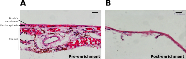 Pre- and post-enrichment microscopy images; histological comparison of choroidal tissue structure.
