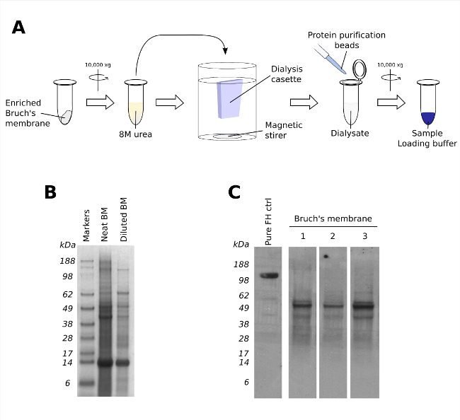 Protein purification process, dialysis diagram with gel electrophoresis results for Bruch's membrane analysis.