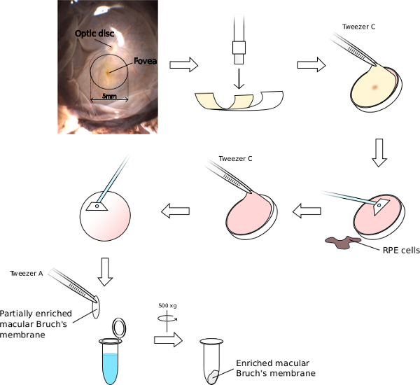 Macular Bruch's membrane enrichment process diagram with RPE cell isolation and centrifugation steps.