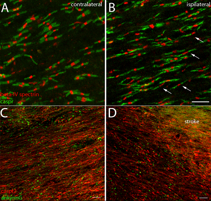 Immunofluorescence microscopy, beta-IV spectrin and caspr in neural tissue, contralateral vs. stroke.