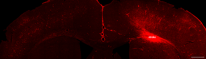 Microscopy image showing brain stroke area, neuron damage, fluorescence illumination, pathology study.