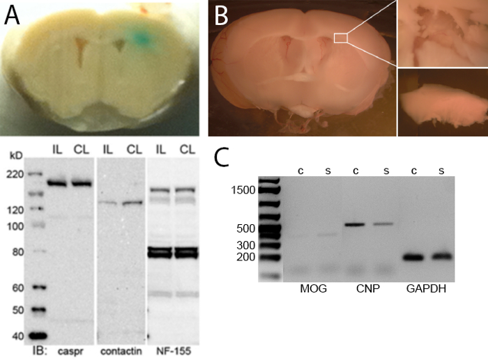 Brain tissue analysis; immunoblot results for caspr, contactin, NF-155; PCR MOG, CNP, GAPDH bands.