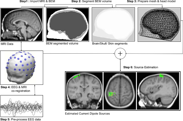 Brain imaging workflow: MRI, BEM segmentation. EEG co-registration. Source estimation results.