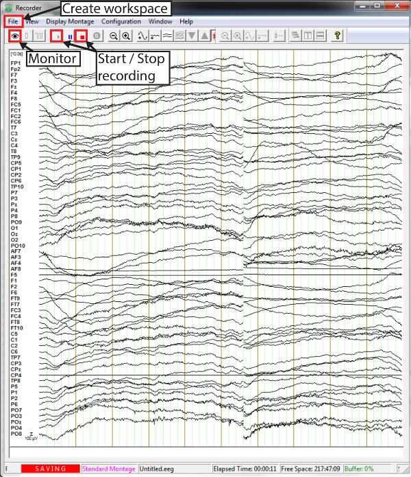 EEG recording screen capture showing brain wave patterns, standard montage setup, data analysis.