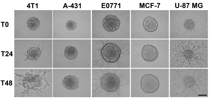 Spheroid growth time-lapse; 4T1, A-431, E0771, MCF-7, U-87 MG cell lines; experiment result.