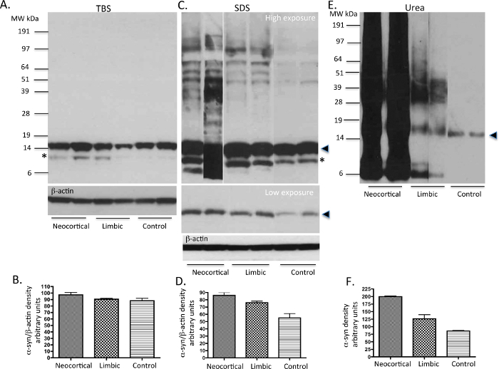 Western blot analysis, protein expression in neocortical, limbic, control; graphs, band density results.