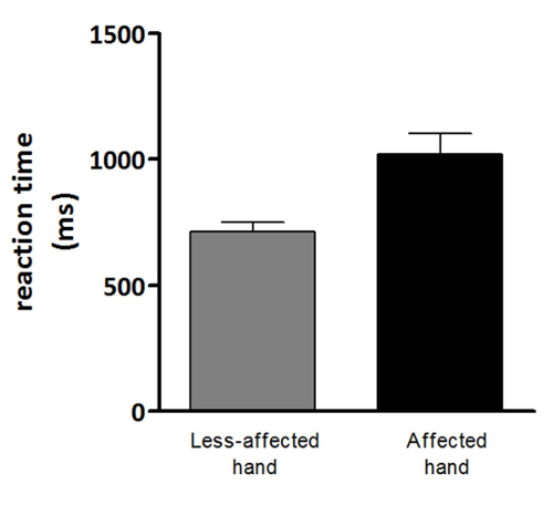 figure-results-5 Bar chart comparing reaction times in milliseconds for affected vs. less-affected hands.