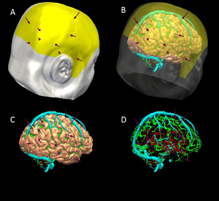 3D brain vasculature models show blood flow pathways; diagram illustrates vascular mapping techniques.