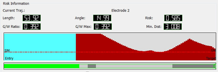 Electrode trajectory risk analysis, diagram showing angle, length, ratio, risk, and distance metrics.