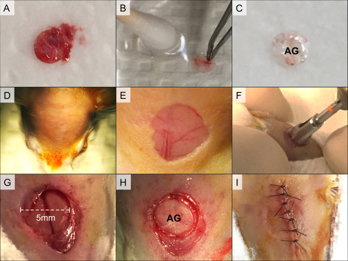 Tissue engineering process; collagen scaffold preparation, implantation site, and wound closure steps.