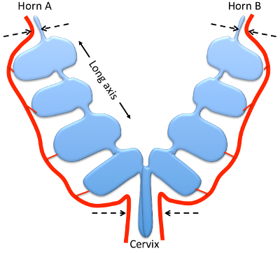 Uterine anatomy diagram; horns and cervix labeled; educational use; reproductive system study.