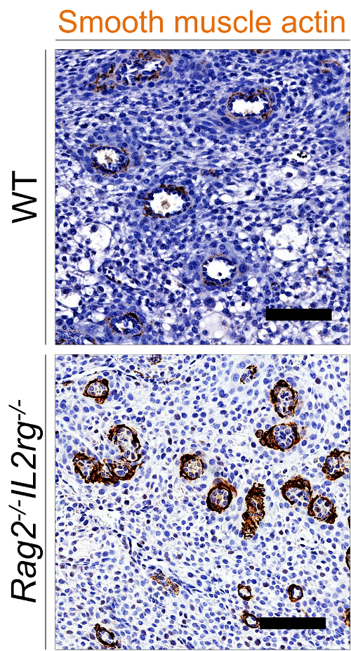 Smooth muscle actin expression in tissue; immunohistochemistry results comparing WT and Rag2–/–Il2rg–/– samples.