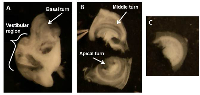 Cochlea anatomy diagram; vestibular region, basal, middle, apical turns labeled for study.