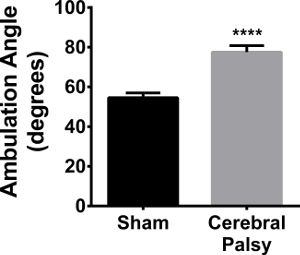 Ambulation angle bar graph comparing cerebral palsy and sham groups, highlighting significant difference.