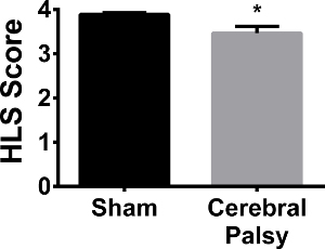 Bar graph comparing HLS scores; Sham vs. Cerebral Palsy; statistical significance indicated.