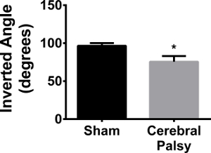 Bar graph comparing inverted angles in sham vs cerebral palsy; statistical result indicated.