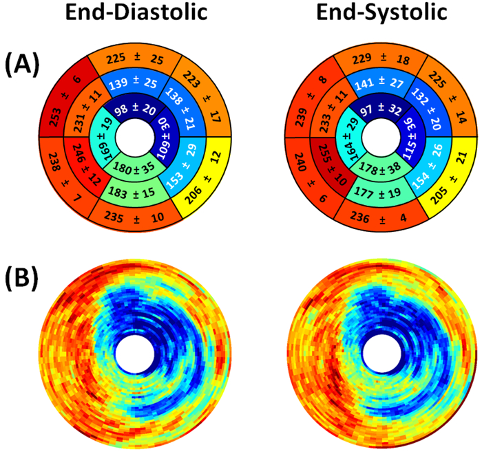 Cardiac polar maps comparing end-diastolic and end-systolic phases in a stress test diagram.