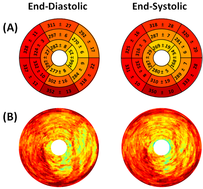 Cardiac function maps: polar plot diagrams showing end-diastolic and end-systolic heart data.