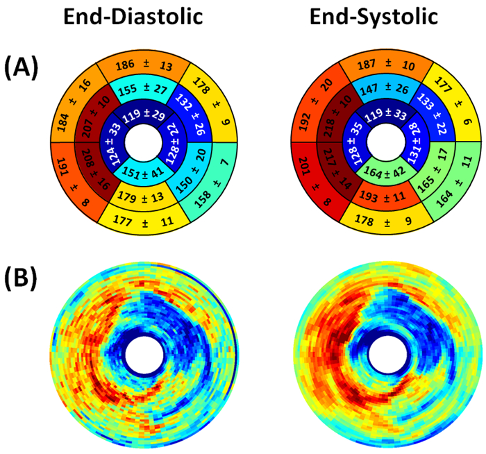 Cardiac MRI diagram showing segmental analysis of end-diastolic and end-systolic phases, 2D maps.