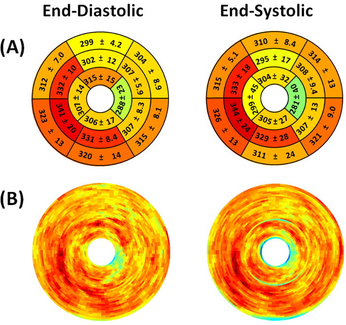 Cardiac MRI analysis showing end-diastolic and end-systolic strain maps, visual results comparison.