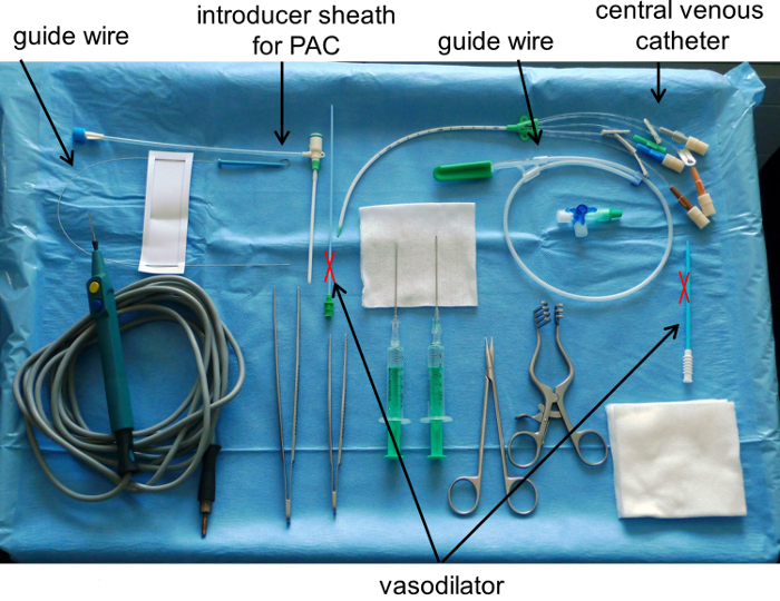 Central venous catheter placement setup with guide wires, sheath, syringes, and tools for vascular access.