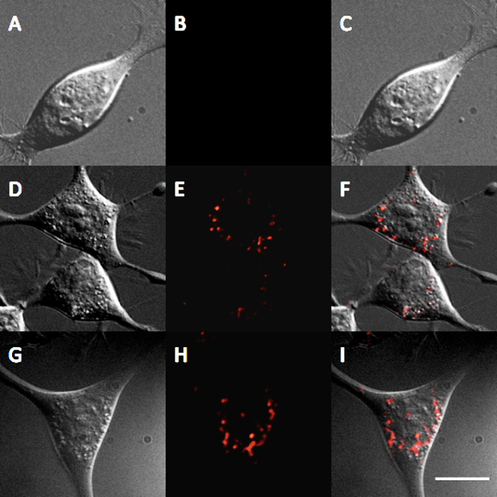 figure-results-5 Cellular dynamic fluorescence microscopy; protein distribution; neuron cells; red fluorescence; microscopy images.