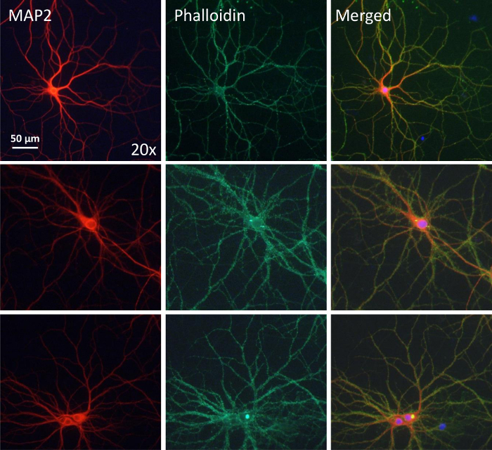Confocal microscopy images of neuron; MAP2 and Phalloidin staining, 20x magnification, merged channels.