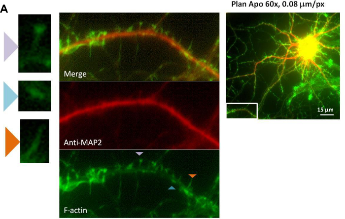 Microscopy diagram of neurons with F-actin and MAP2 labeling; fluorescence imaging.