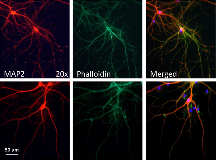 Immunofluorescence microscopy of neurons; MAP2 (red), phalloidin (green), merged, highlights structure.