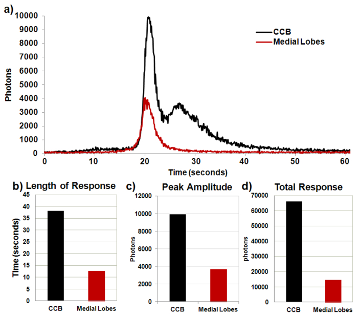 Photon response graphs; chart visualizing response duration, amplitude, and total for CCB, Medial Lobes.
