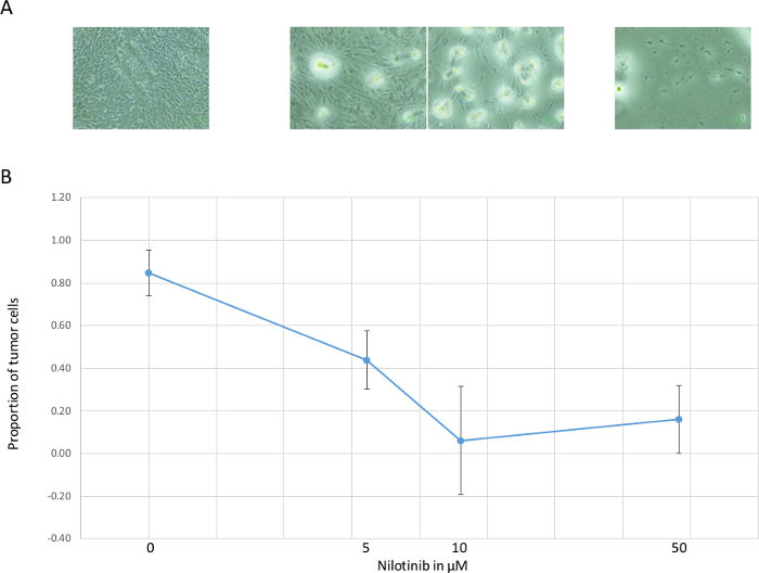 figure-results-3 Microscopy images of tumor cells with nilotinib doses and a graph of cellular response.